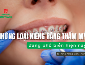 Có những loại niềng răng thẩm mỹ nào đang phổ biến hiện nay