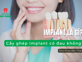 Implant là gì? Cấy ghép Implant răng có đau không?
