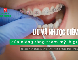 Ưu và nhược điểm của niềng răng thẩm mỹ là gì? Tại sao nên chọn niềng răng ở Nha Khoa Bến Thành