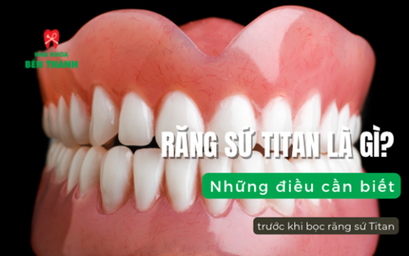 Răng Sứ Titan là gì? Những điều cần biết trước khi bọc răng sứ Titan